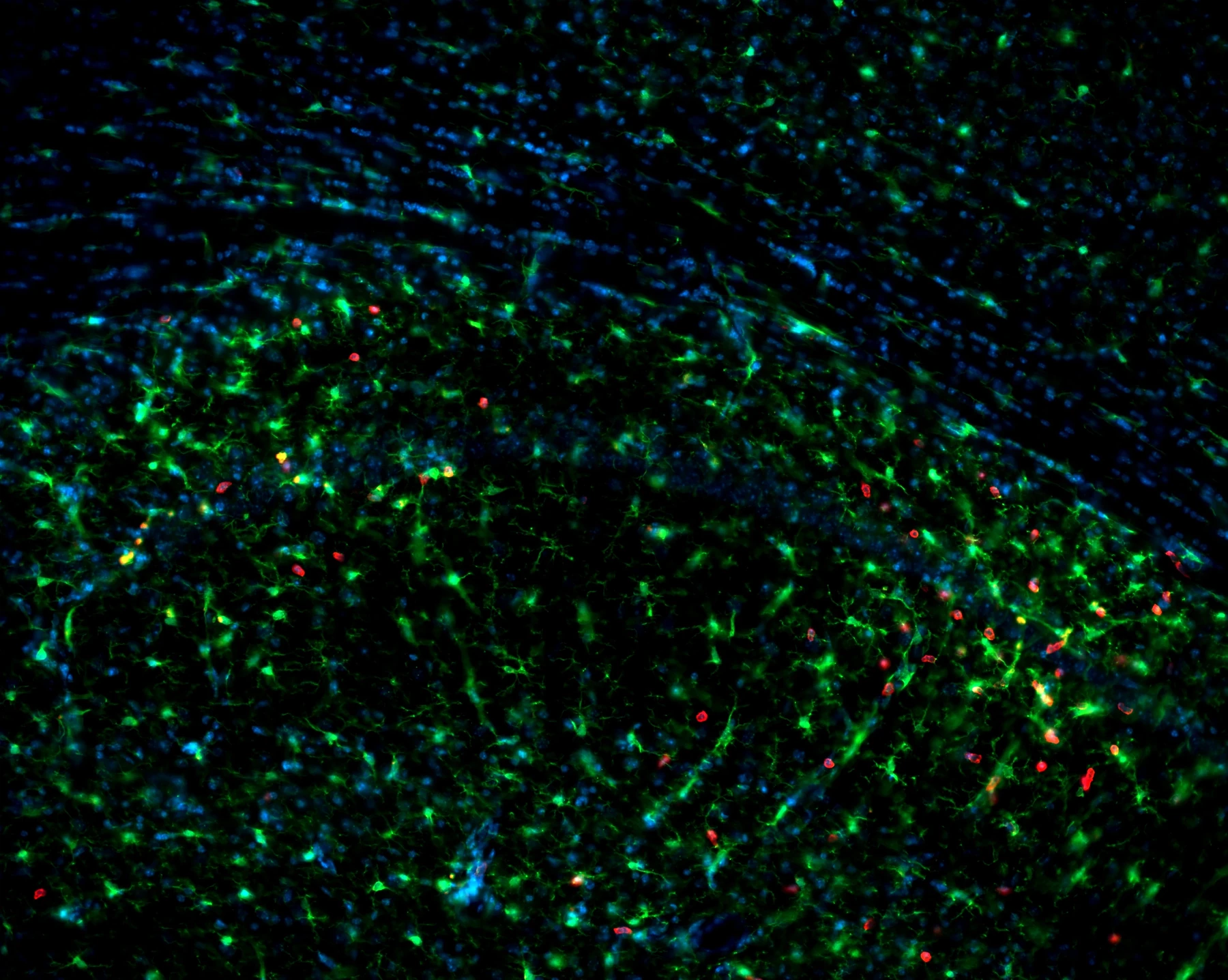 Iba1 CD45 Hoechst TAg/OFF NCCR hippocampus coronal 20x immunofluorescence