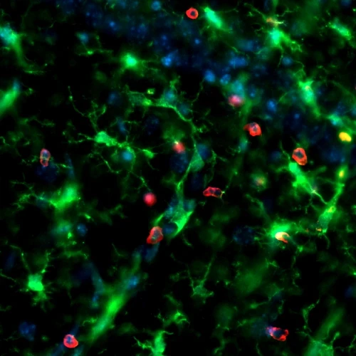 Iba1 CD45 Hoechst TAg/OFF NCCR hippocampus inset coronal 20x immunofluorescence