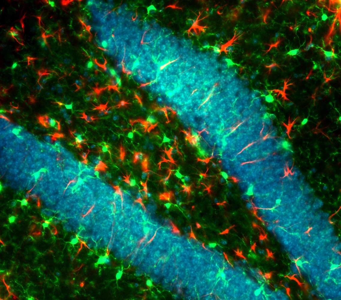 Iba1 GFAP Hoechst TAg/OFF NCCR hippocampus coronal 20x immunofluorescence