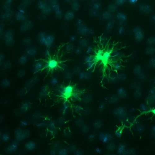 Iba1 Hoechst TAg/OFF PLX5622 CSF1R inhibitor microglial depletion cortex inset coronal 20x immunofluorescence