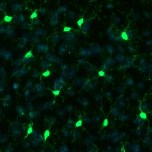 Iba1 Hoechst TAg/OFF regular diet cortex inset coronal 20x immunofluorescence