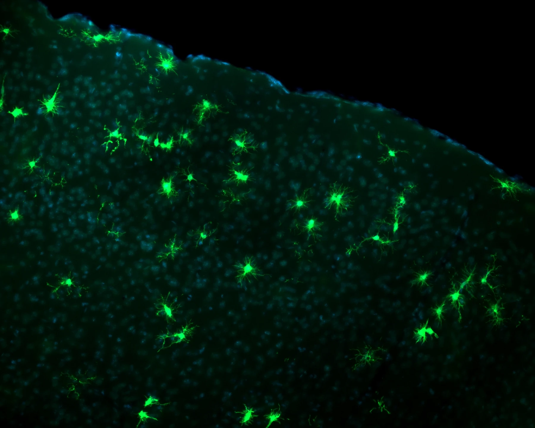 Iba1 Hoechst TAg/OFF PLX5622 CSF1R inhibitor microglial depletion cortex coronal 20x immunofluorescence