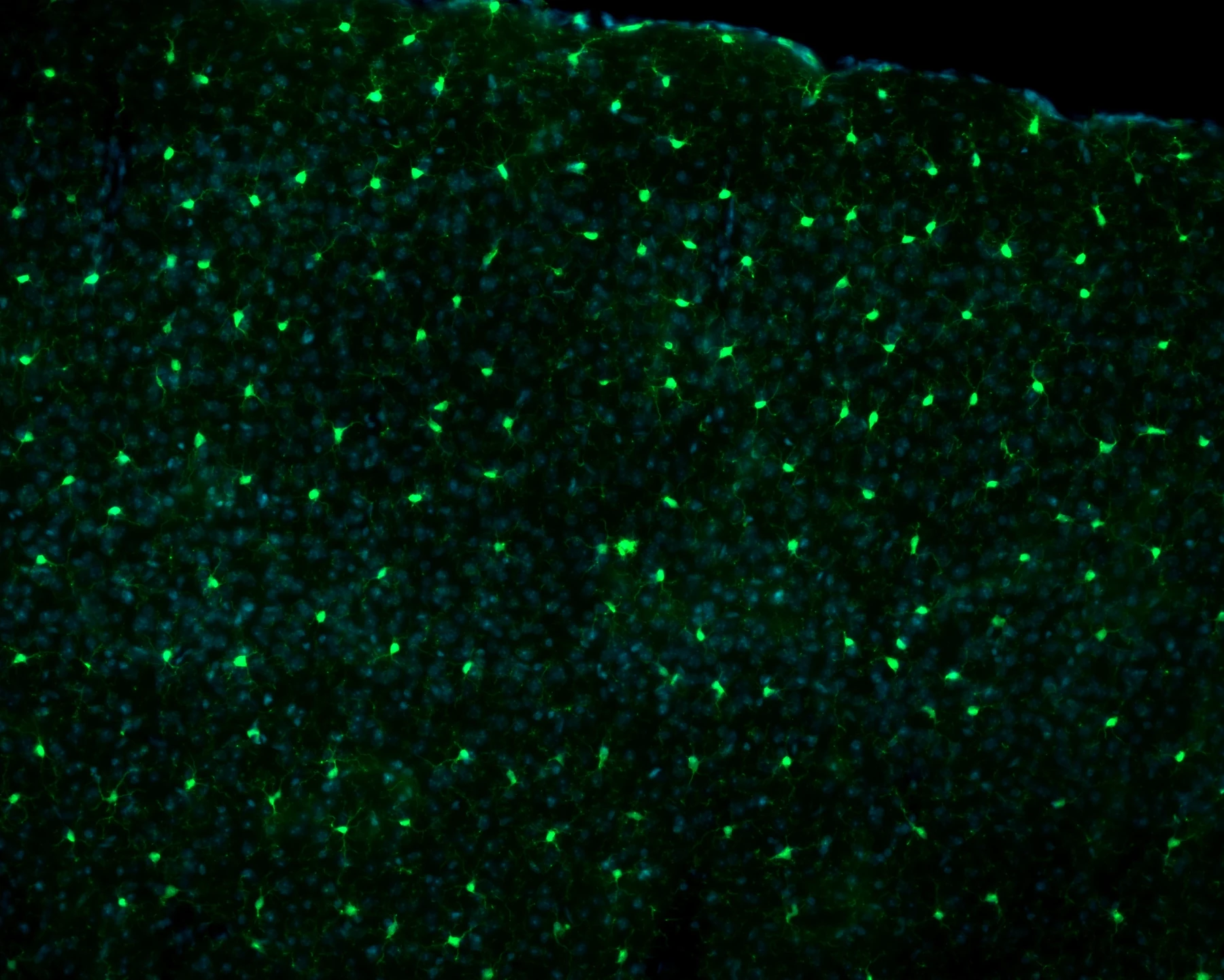 Iba1 Hoechst TAg/OFF regular diet cortex coronal 20x immunofluorescence